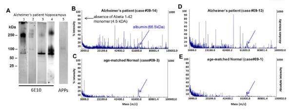 Beta Amyloid (1-42).jpg