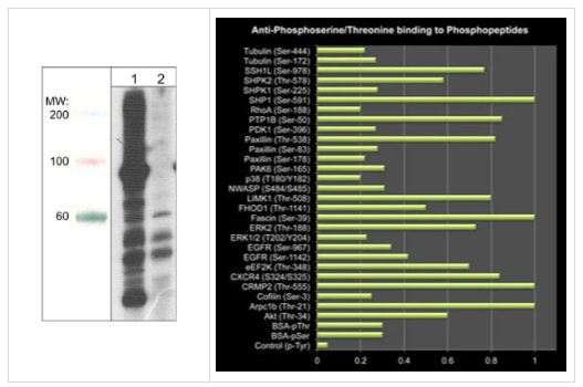 Anti-Phosphoserine/threonine Antibody磷酸抗体