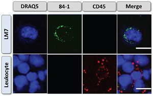 Immunofluorescence staining of CSV.jpg