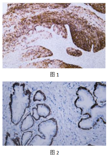 IHCAb CK14鼠单抗 (BGT047)