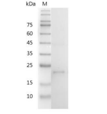 重组小鼠IL-12 p35的SDS-PAGE分析