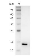 重组人白细胞介素-22的SDS-PAGE分析