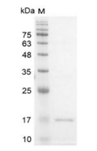 重组人IFN-γ的SDS-PAGE分析