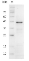 重组人PGA5的SDS-PAGE分析