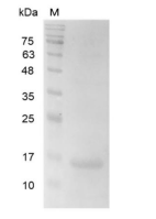 重组人Galectin-2的SDS-PAGE分析