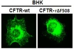 conductance-regulator-cftr-antibody.jpg