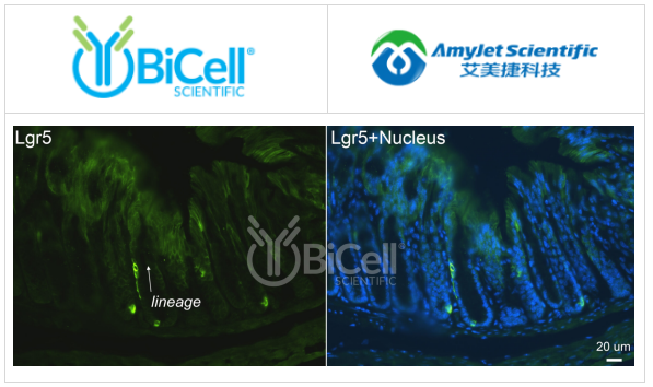 LGR5（GPR49或GPR67）抗体