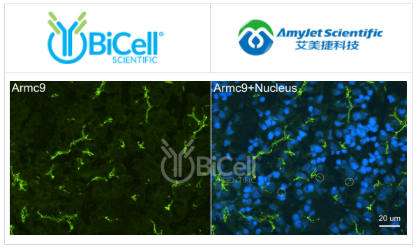 Bicell Scientific-ARMC9抗体染色