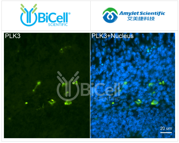 Bicell Scientific-PLK3（CNK）抗体