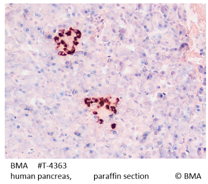 Antibody T-4363.png