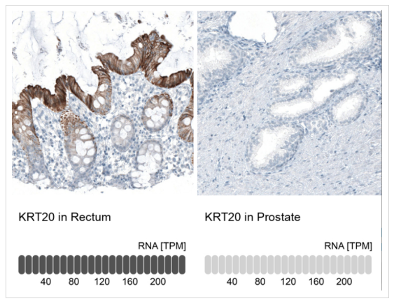 Atlas antibodies