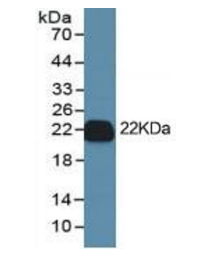 antibodies-online-IL-1 beta ELISA Kit