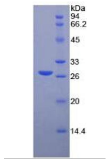 antibodies-online-MMP2 ELISA Kit