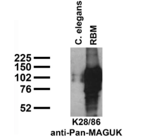 用K28/86 TC supe探针对成年大鼠（RBM）的秀丽隐杆线虫粗提取物和粗脑膜进行免疫印迹