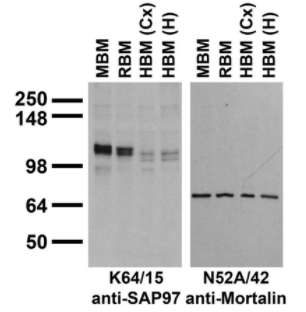 抗SAP97抗体