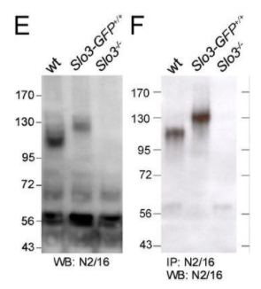 来自NeuroMab的抗KCNU1/Slo3 pH敏感的maxi-K+通道小鼠单克隆一抗是由杂交瘤克隆N2/16在内部生产的。它经过KO验证，检测小鼠、爪蟾KCNU1/Slo3 pH敏感的最大K+通道，并通过蛋白A色谱纯化。它非常适合在EM、ICC、IP、WB中使用。     艾美捷NeuroMab抗KCNU1/Slo3 pH敏感性Maxi-K+通道抗体（N2/16）：  货号 75-056  目标：KCNU1/Slo3 pH敏感型最大K+通道  目标描述：由KCNU1基因编码的钾钙激活通道亚家族U成员1是钾通道家族的一员，属于钙激活的（TC 1.A.1.3）亚家族，KCa5.1/KCNU1次亚家族。KCNU1是一个睾丸特异性的钾通道，通过细胞内pH和膜电压激活，介导K+的运输。KCNU1在睾丸中表达。与KCNU1相关的疾病包括脑白质营养不良、低髓鞘化3型和Coffin-Siris综合征1型。  格式：通过蛋白A色谱法纯化  浓度：1毫克/毫升  克隆性：单克隆  克隆：N2/16  亚型：IgG1  应用：电镜（EM）、免疫细胞化学（ICC）、免疫沉淀（IP）、西方印迹（WB）  宿主物种：小鼠  基因名称：Kcnu1 Kcnma3 Ksper Slo3  分子量：115千道尔顿  抗原：小鼠Slo3（访问号O54982）的融合蛋白氨基酸1052-1121，在大肠杆菌中重组产生  物种反应性：沙鼠、小鼠  储存：分装后在-20°C以下长期储存。短期储存在2-8°C。为了最大限度地恢复产品，取下盖子前先离心管。  物理状态：液体  生产说明：通过体外生物反应器培养杂交瘤细胞系，然后通过蛋白A亲和色谱法生产。纯化的单克隆抗体特异性抗体超过90%。  缓冲液：10 mM Tris，50 mM 氯化钠，0.065% 叠氮化钠 pH 7.4  稀释范围：WB: 1:500  偶联物：未偶联  特异性：未报告交叉反应  质量控制：每批新抗体都在过表达目标蛋白的细胞上进行质量控制测试，并确认给出预期的染色模式。  使用说明：这些抗体用作研究实验室试剂，不用于人类诊断或治疗试剂。  有效期：自收货之日起24个月  运输：冰袋运输  同义词：钾通道亚家族U成员1（钙激活钾通道亚单位α-3）（钙激活钾通道，亚家族M亚单位α-3）（精子特异性碱化激活K(+)电流的孔形成亚单位）（KSper）（Slowpoke同源物3）（mSlo3）（pH敏感型最大钾通道）  UniProt详情：UniProt（人类）: A8MYU2  UniProt（免疫原物种）: O54982  71.png  免疫印迹与来自野生型（wt）、Slo3-eGFP和Slo3-/-敲除小鼠睾丸的（E）膜蛋白以及用N2/16探测的N2/16拉下的总睾丸蛋白的（F）免疫沉淀产物的比较。数据由Christopher Lingle（华盛顿大学）提供，并经美国国家科学院院刊许可转载（2011 Zeng等人，PMID 21427226）。     NeuroMab 旨在构建一个新的神经元蛋白库。NeuroMab专注于研究膜蛋白（受体/通道/转运）、突触蛋白和其他神经元信号分子。随后，NeuroMab逐渐扩大了其产品线的范围，现在涵盖了神经科学和生物医学基础研究的其他领域。NeuroMab为哺乳动物大脑的生化和免疫组织化学实验提供低成本、高质量的小鼠单克隆抗体。目前NeuroMab已经开发了近500种抗体，其中许多已在小鼠脑中进行了敲除验证。     艾美捷科技是NeuroMab的中国代理商，为科研工作者提供优质的产品与服务。