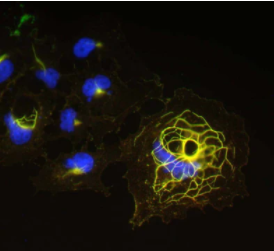 转染细胞免疫荧光染色N22/21=绿色，兔抗Shank1=红色，DAPI=蓝色。