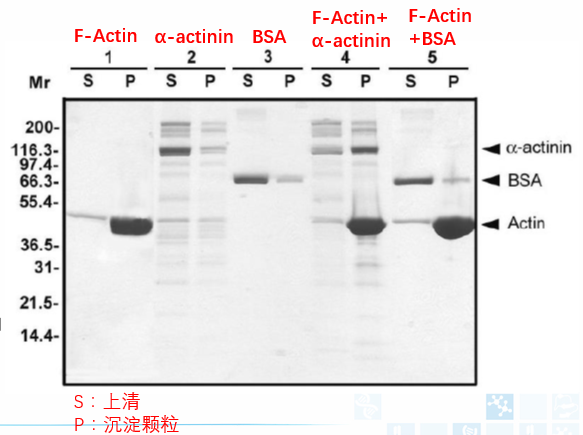 Actin结合蛋白分析试剂盒.png